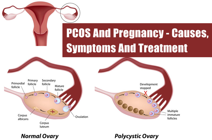 Do Fertility Treatment Work For Natural Pregnancy Do Fertility Treatment Work For Natural Pregnancy